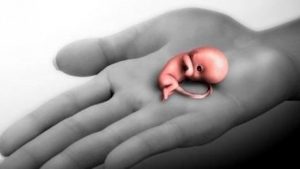 Çocuk Düşürtme Suçu Nedir? ( Yasa Dışı Kürtaj) 